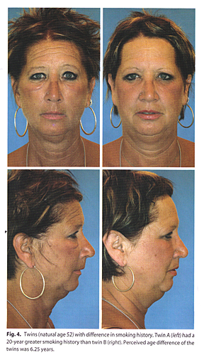 Chicago smoking plastic surgery 2